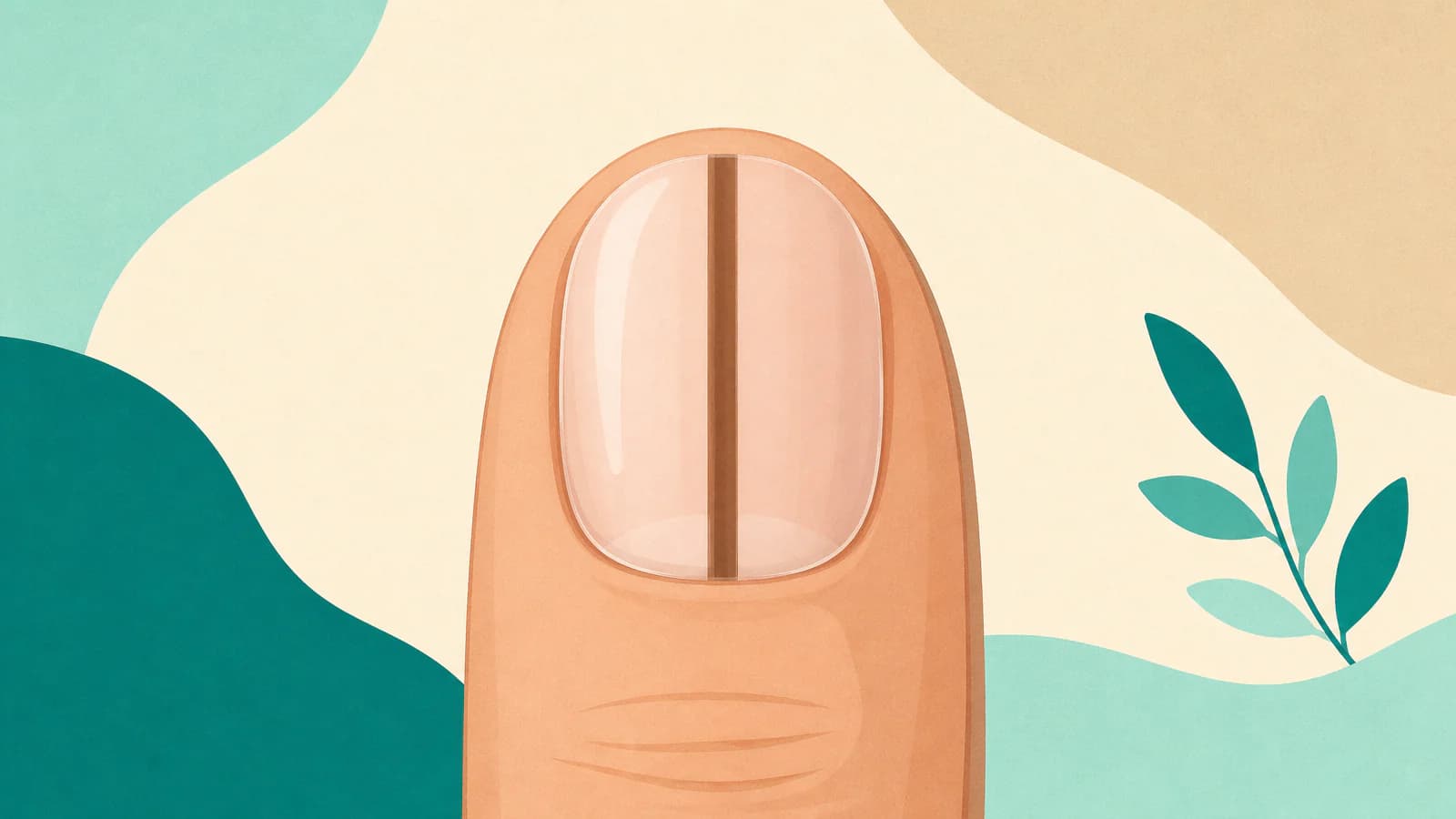 Illustration eines Fingernagels mit einem dünnen braunen senkrechten Streifen von der Nagelhaut bis zur Spitze