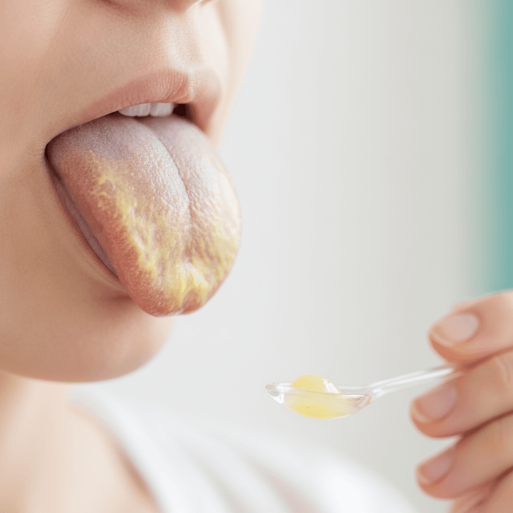 Tongue with a yellow coating