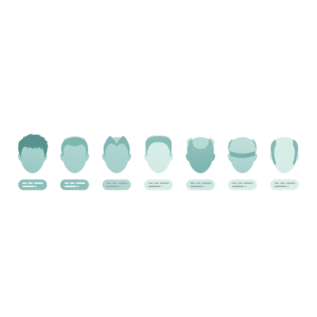 The seven stages of the Norwood scale shown as a row of heads
